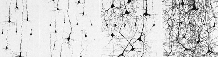 neuroplasticity-banner-00c2e9f8c61d3ba494eec96b8eb0269a